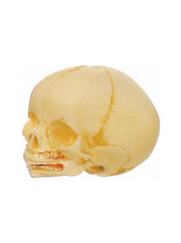 GD/A 1115 Infant Skull