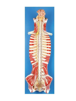 GD/A18102 Spinal Cord In The Spinal Canal