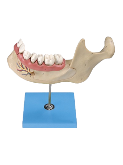 LOWER JAW OF 18 YEAR OLD 