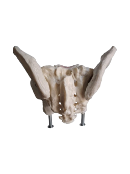 ADULT FEMALE PELVIS