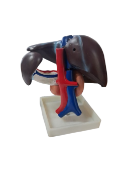 LIVER PANCREAS AND DUODENUM MODEL